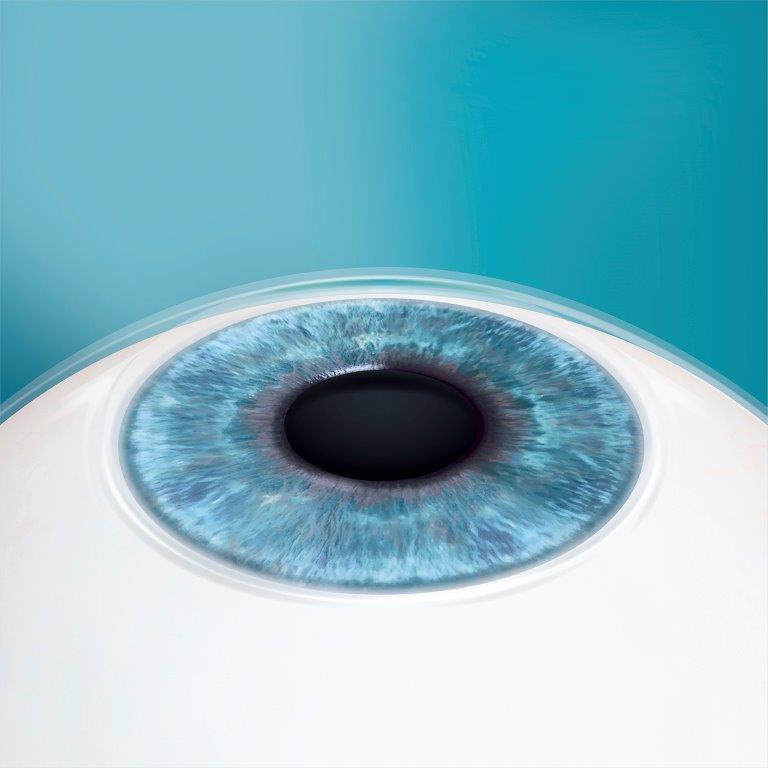 viziunea-scapadeochelari